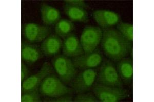 Immunocytochemistry staining of HeLa cells fixed with 4 % Paraformaldehyde and using anti-hHR23b antibody (dilution 1:100). (RAD23B anticorps)