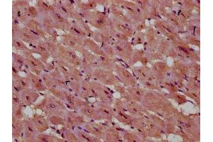IHC image of ABIN7142862 diluted at 1:400 and staining in paraffin-embedded human heart tissue performed on a Leica BondTM system.