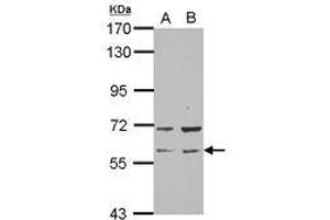 Image no. 2 for anti-RAP1, GTP-GDP Dissociation Stimulator 1 (RAP1GDS1) (N-Term) antibody (ABIN1494067) (RAP1GDS1 anticorps  (N-Term))