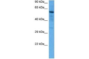 Host:  Mouse  Target Name:  SOX9  Sample Tissue:  Mouse Brain  Antibody Dilution:  1ug/ml (SOX9 anticorps  (N-Term))