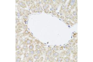 Immunohistochemistry of paraffin-embedded mouse liver using SAA3 antibody. (Serum Amyloid A3 Pseudogene (SAA3P) anticorps)