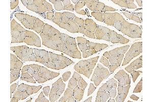 ABIN7096942 and ABIN7101008 at 1/100 staining mouse muscle tissue by IHC-P. (C22orf9 anticorps)