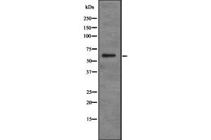 Western blot analysis of PDP2 expression in Jurkat cell lysate,The lane on the left is treated with the antigen-specific peptide. (PDP2 anticorps  (N-Term))