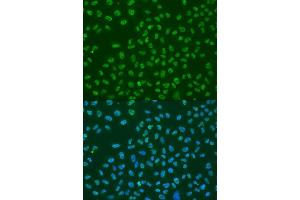Immunofluorescence analysis of U2OS cells using ELAVL1 antibody.