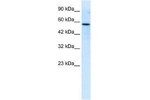 Human Jurkat; WB Suggested Anti-RIPX Antibody Titration: 0. (RUFY3 anticorps  (C-Term))