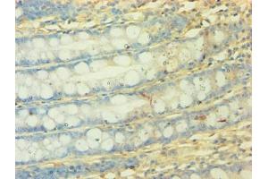 Immunohistochemistry of paraffin-embedded human colon tissue using ABIN7160897 at dilution of 1:50