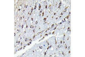 Immunohistochemistry of paraffin-embedded rat brain using TTC11/FIS1 antibody (ABIN7267209) at dilution of 1:100 (40x lens).