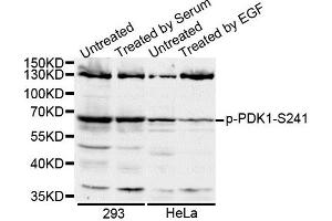 Western blot analysis of extracts of various cell lines, using Phospho-PDK1-S241 antibody. (PDPK1 anticorps  (pSer241))
