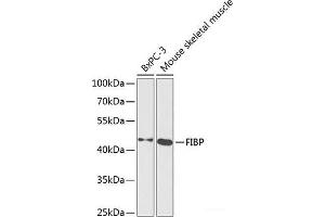 Western blot analysis of extracts of various cell lines using FIBP Polyclonal Antibody at dilution of 1:1000. (FIBP anticorps)
