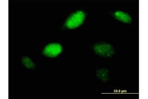 Immunofluorescence of purified MaxPab antibody to PHOX2A on HeLa cell.