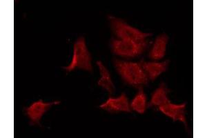 ABIN6269073 staining COS7 by IF/ICC. (ABL1 anticorps)