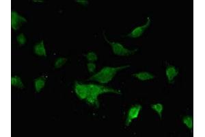 Immunofluorescent analysis of U251 cells using ABIN7153058 at dilution of 1:100 and Alexa Fluor 488-congugated AffiniPure Goat Anti-Rabbit IgG(H+L)