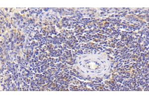 Detection of IL18 in Human Spleen Tissue using Monoclonal Antibody to Interleukin 18 (IL18) (IL-18 anticorps  (AA 94-193))