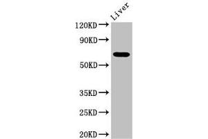 Western Blot Positive WB detected in: Mouse liver tissue All lanes: SENP2 antibody at 3. (SENP2 anticorps  (AA 138-324))