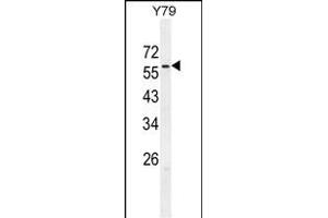 ZN Antibody (C-term) (ABIN654976 and ABIN2844616) western blot analysis in Y79 cell line lysates (35 μg/lane). (ZNF678 anticorps  (C-Term))