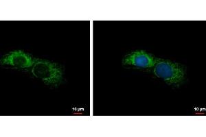 ICC/IF Image ALDH7A1 antibody detects ALDH7A1 protein at mitochondria by immunofluorescent analysis. (ALDH7A1 anticorps)