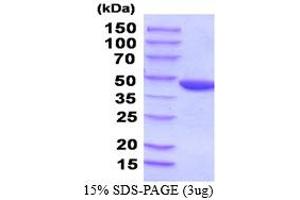 SDS-PAGE (SDS) image for Phosphoglycerate Kinase 2 (PGK2) (AA 1-417) (Active) protein (His tag) (ABIN5854495)