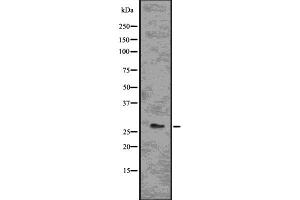 Western blot analysis of BCL2A1 using Jurkat whole  lysates. (BCL2A1 anticorps  (Internal Region))