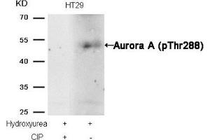 Western blot analysis of extracts from HT29 cells, treated with Hydroxyurea or calf intestinal phosphatase (CIP), using Aurora A (phospho-Thr288) Antibody. (Aurora A anticorps  (pThr288))