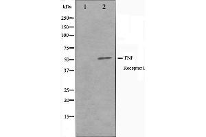 Western blot analysis of TNFR1 Antibody expression in A549 cells lysates.