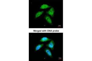 ICC/IF Image Immunofluorescence analysis of paraformaldehyde-fixed HeLa, using CtBP1, antibody at 1:200 dilution.