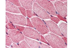 Anti-AES antibody IHC of human skeletal muscle. (AES anticorps  (C-Term))