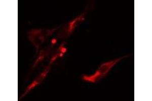ABIN6275614 staining  LOVO cells by IF/ICC. (UBASH3A anticorps  (Internal Region))
