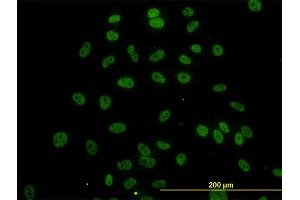 Immunofluorescence of monoclonal antibody to SURB7 on HeLa cell. (MED21 anticorps  (AA 1-144))