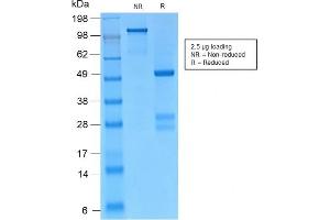 SDS-PAGE Analysis Purified Catenin, gamma Rabbit Monoclonal Antibody (CTNG/2155R). (Recombinant JUP anticorps)