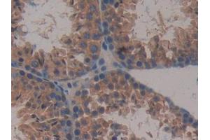IHC-P analysis of Mouse Testis Tissue, with DAB staining. (MAPKAP Kinase 2 anticorps  (AA 117-337))