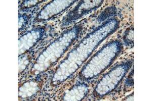 IHC-P analysis of Human Rectum Tissue, with DAB staining. (CHI3L1 anticorps  (AA 112-377))