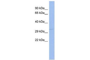 WB Suggested Anti-SIX1 Antibody Titration:  0. (SIX Homeobox 1 anticorps  (Middle Region))