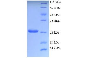 SDS-PAGE (SDS) image for Tryptase alpha/beta 1 (TPSAB1) (AA 703-895), (partial) protein (His tag) (ABIN5713026)