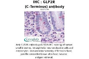 Image no. 1 for anti-Glucagon-Like Peptide 2 Receptor (GLP2R) (C-Term) antibody (ABIN1734731) (GLP2R anticorps  (C-Term))