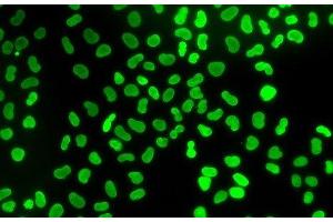 Immunofluorescence analysis of U2OS cells using TMPO Polyclonal Antibody (Thymopoietin anticorps)