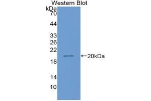 Western blot analysis of the recombinant protein. (HNF1B anticorps  (AA 159-300))