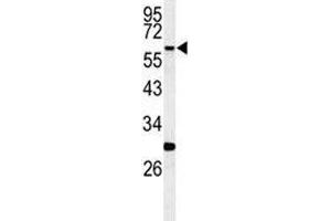 Western blot analysis of RIPK3 antibody and mouse cerebellum tissue lysate