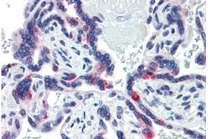 Human Placenta (formalin-fixed, paraffin-embedded) stained with SIN3A antibody ABIN462178 followed by biotinylated goat anti-rabbit IgG secondary antibody ABIN481713, alkaline phosphatase-streptavidin and chromogen.