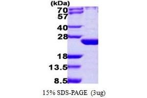 SDS-PAGE (SDS) image for ADP Ribosylation Factor Like GTPase 6 (ARL6) (AA 1-186) protein (His tag) (ABIN667468) (ARL6 Protein (AA 1-186) (His tag))