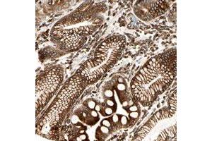 Immunohistochemical staining of human stomach with TAPBP polyclonal antibody  shows strong cytoplasmic and membranous positivity in glandular cells at 1:20-1:50 dilution. (TAPBP anticorps)