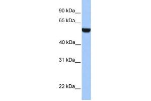 WB Suggested Anti-PHF17 Antibody Titration:  0. (PHF17 anticorps  (C-Term))