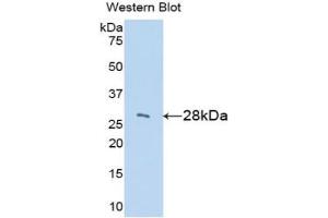 Western blot analysis of the recombinant protein. (IGFBP2 anticorps  (AA 35-304))