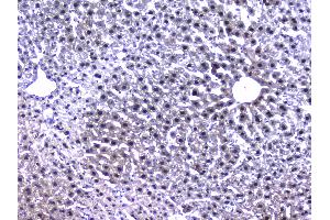 IHC analysis of RXRA using anti-RXRA antibody .
