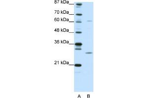 WB Suggested Anti-CRSP9 Antibody Titration:  0. (MED7 anticorps  (N-Term))
