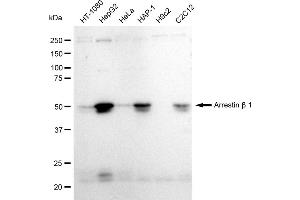 Western blotting analysis using Arrestin beta 1 antibody (ABIN7797653).