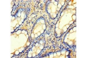 Immunohistochemistry of paraffin-embedded human small intestine tissue using ABIN7145543 at dilution of 1:100 (BCMO1 anticorps  (AA 1-300))