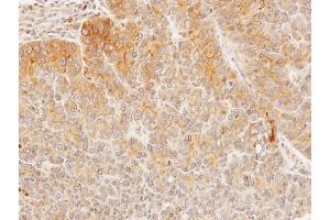 IHC-P Image Immunohistochemical analysis of paraffin-embedded SW480 xenograft, using Seladin 1, antibody at 1:100 dilution.