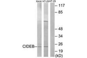 Western Blotting (WB) image for anti-Cell Death-Inducing DFFA-Like Effector B (CIDEB) (AA 91-140) antibody (ABIN2889982) (CIDEB anticorps  (AA 91-140))