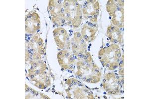 Immunohistochemistry of paraffin-embedded human stomach using BAG5 antibody (ABIN5975259) at dilution of 1/100 (40x lens).
