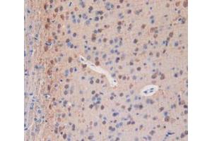IHC-P analysis of Mouse Brain Tissue, with DAB staining. (PLA2R1 anticorps  (AA 1418-1487))